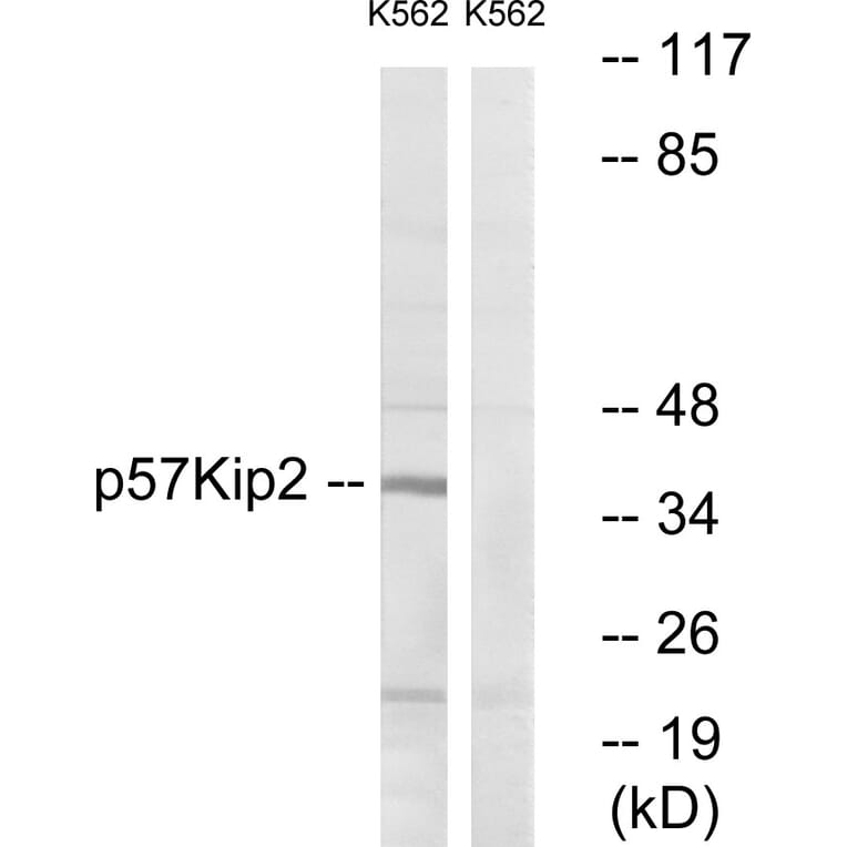 Western Blot - Anti-p57 Kip2 Antibody (B0967) - Antibodies.com