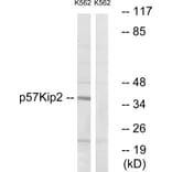 Western Blot - Anti-p57 Kip2 Antibody (B0967) - Antibodies.com