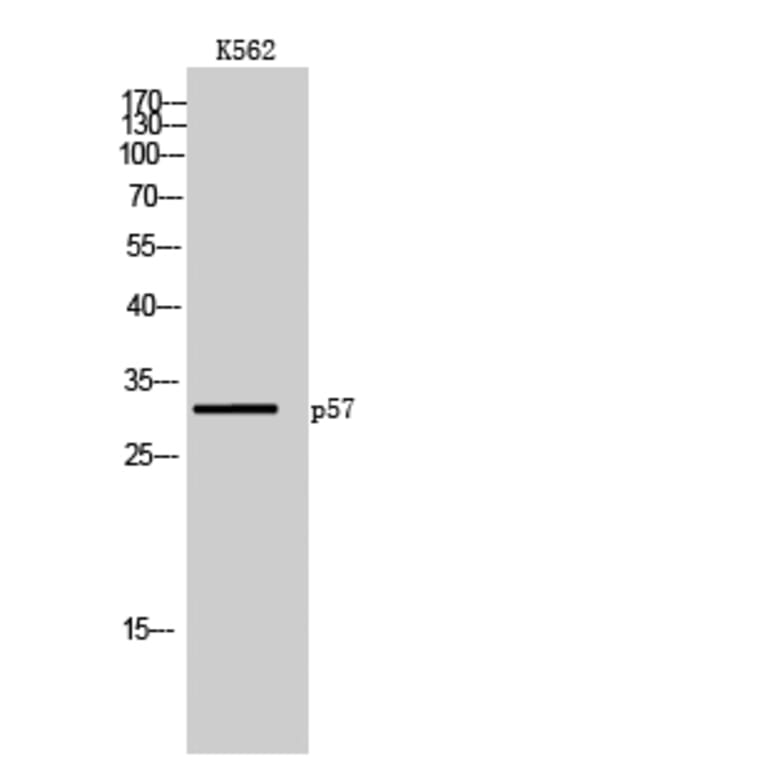 Western Blot - Anti-p57 Kip2 Antibody (B0967) - Antibodies.com