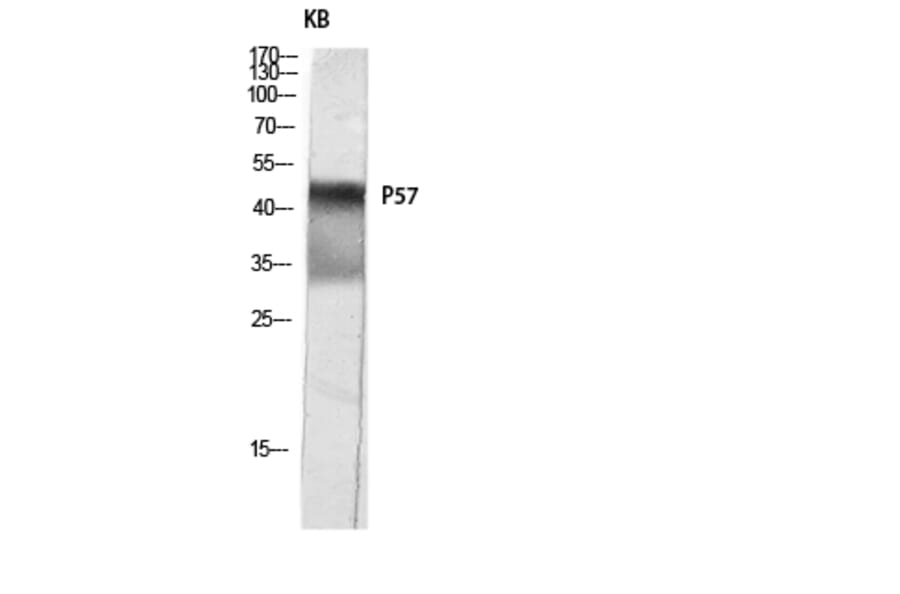 Western Blot - Anti-p57 Kip2 Antibody (B0967) - Antibodies.com