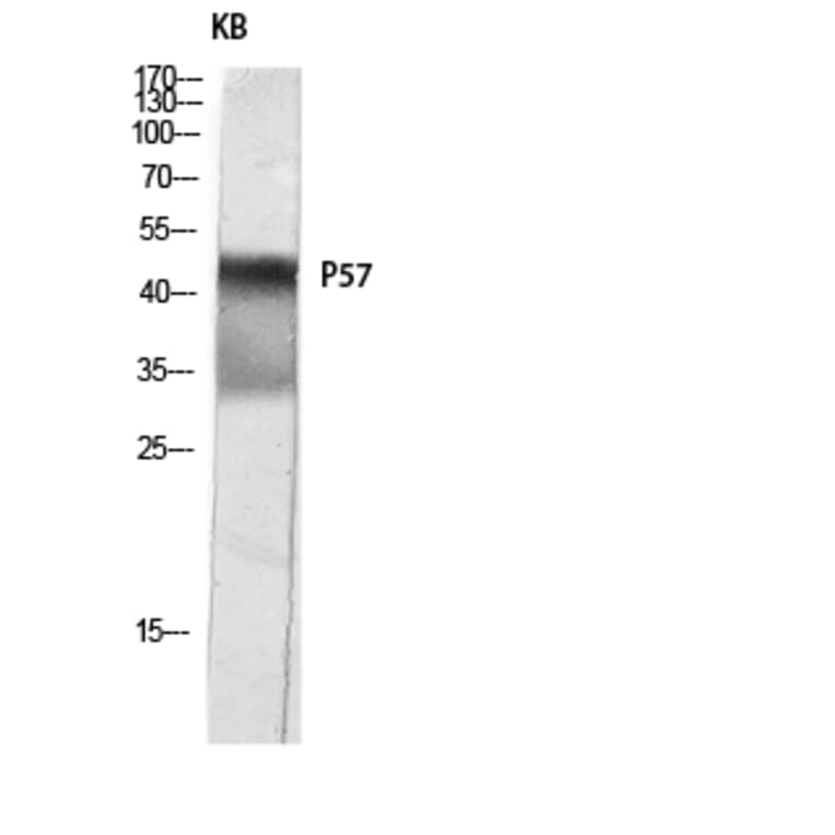 Western Blot - Anti-p57 Kip2 Antibody (B0967) - Antibodies.com
