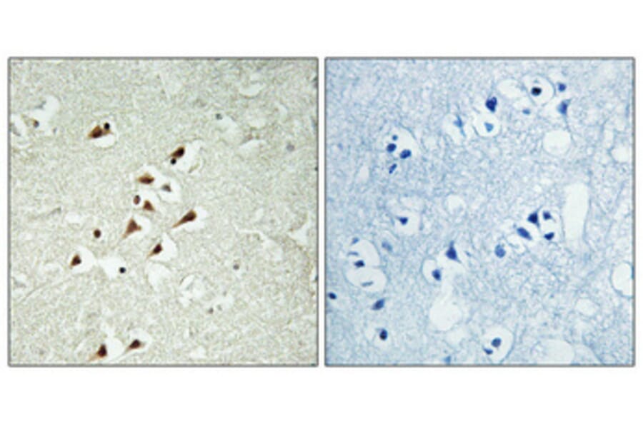Immunohistochemistry - Anti-TUBGCP5 Antibody (C15873) - Antibodies.com