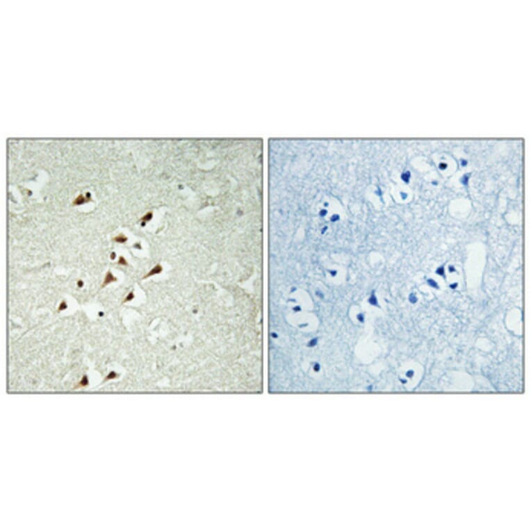 Immunohistochemistry - Anti-TUBGCP5 Antibody (C15873) - Antibodies.com