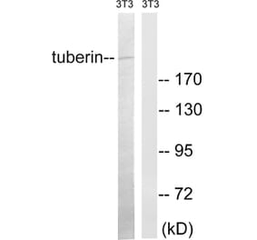 Western Blot - Anti-Tuberin Antibody (B8443) - Antibodies.com