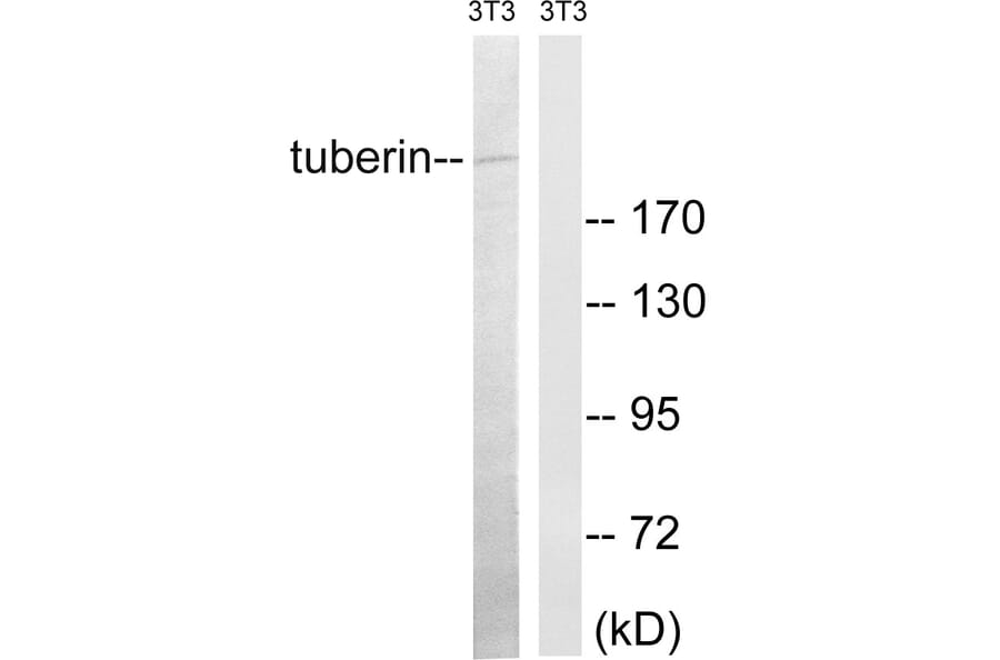 Western Blot - Anti-Tuberin Antibody (B8443) - Antibodies.com
