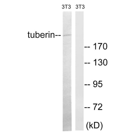 Western Blot - Anti-Tuberin Antibody (B8443) - Antibodies.com