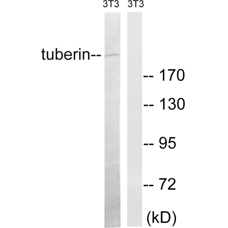 Western Blot - Anti-Tuberin Antibody (B8443) - Antibodies.com