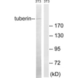Western Blot - Anti-Tuberin Antibody (B8443) - Antibodies.com