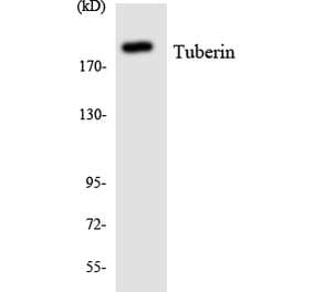 Western Blot - Anti-Tuberin Antibody (R12-3658) - Antibodies.com