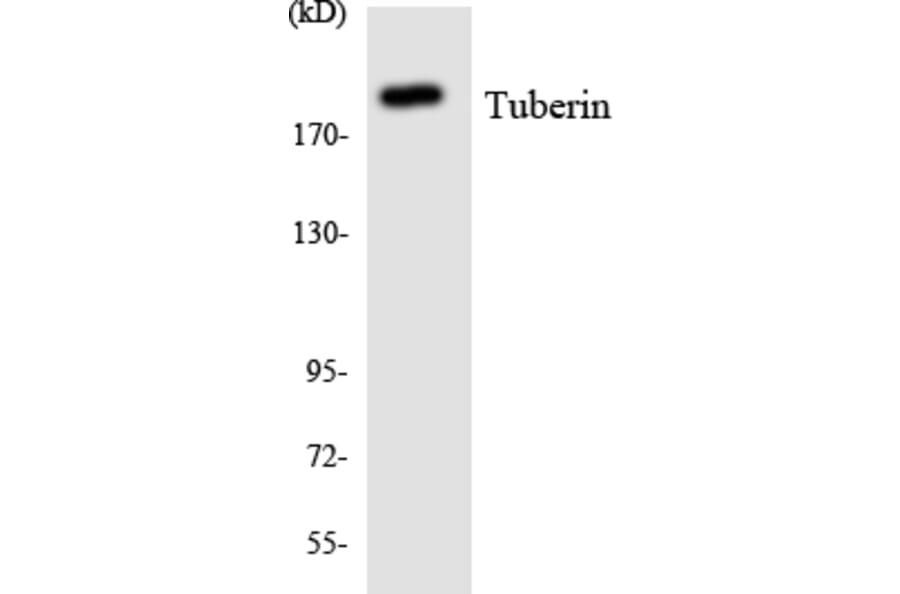 Western Blot - Anti-Tuberin Antibody (R12-3658) - Antibodies.com