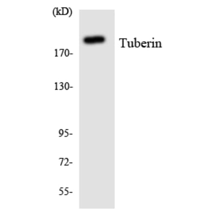 Western Blot - Anti-Tuberin Antibody (R12-3658) - Antibodies.com