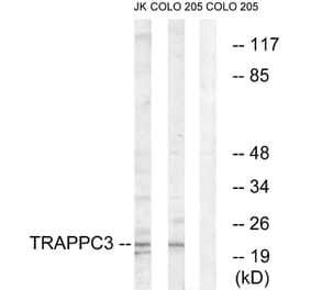 Western Blot - Anti-TRAPPC3 Antibody (C19146) - Antibodies.com