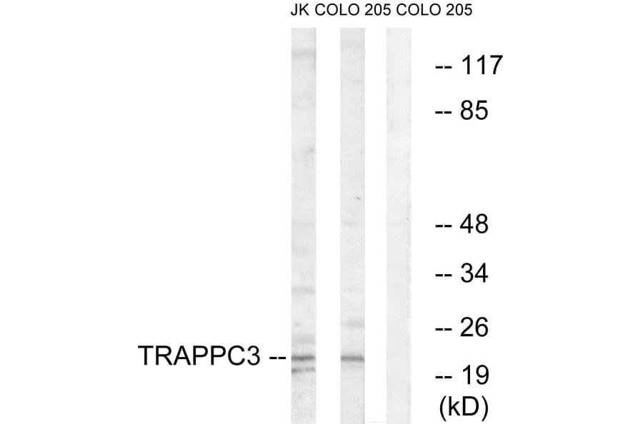 Western Blot - Anti-TRAPPC3 Antibody (C19146) - Antibodies.com