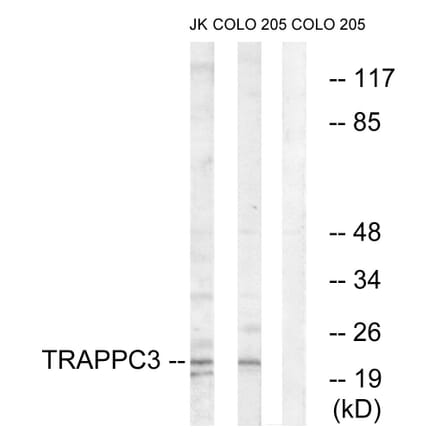 Western Blot - Anti-TRAPPC3 Antibody (C19146) - Antibodies.com