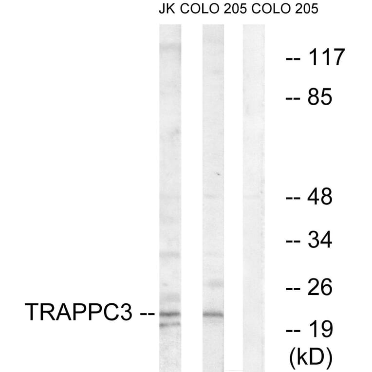 Western Blot - Anti-TRAPPC3 Antibody (C19146) - Antibodies.com