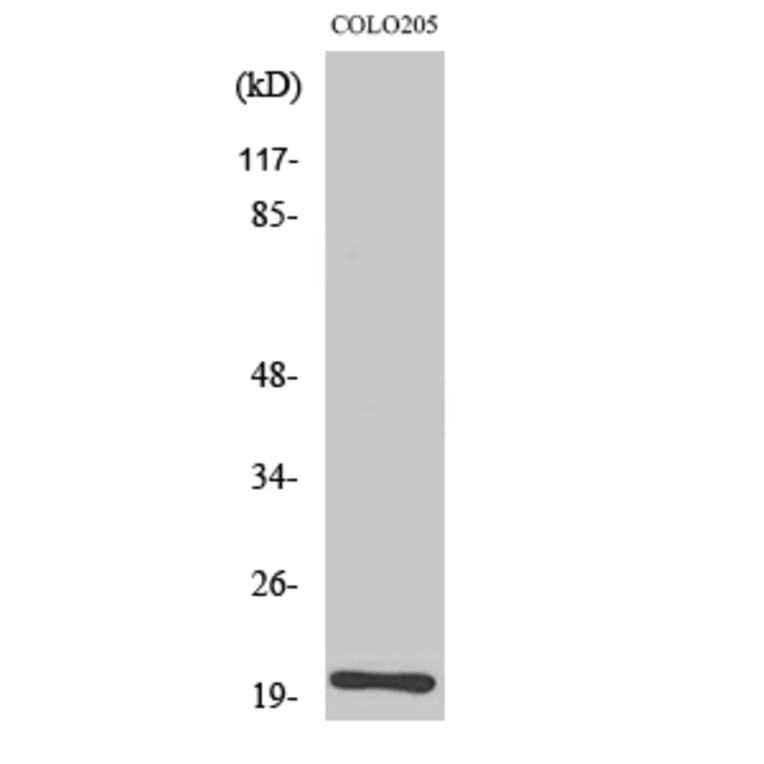 Western Blot - Anti-TRAPPC3 Antibody (C19146) - Antibodies.com