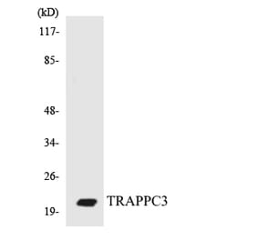 Western Blot - Anti-TRAPPC3 Antibody (R12-3648) - Antibodies.com