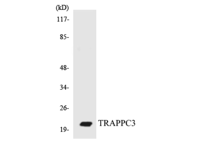 Western Blot - Anti-TRAPPC3 Antibody (R12-3648) - Antibodies.com