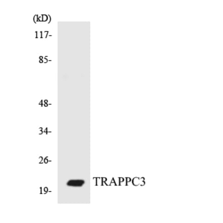 Western Blot - Anti-TRAPPC3 Antibody (R12-3648) - Antibodies.com