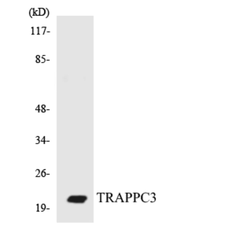 Western Blot - Anti-TRAPPC3 Antibody (R12-3648) - Antibodies.com