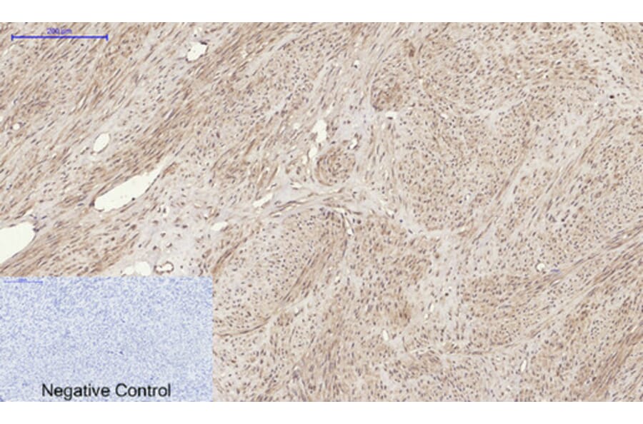 Immunohistochemistry - Anti-TNFSF11 Antibody (C30535) - Antibodies.com