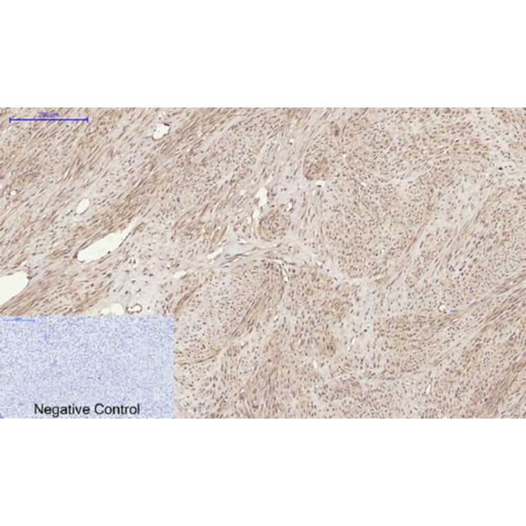 Immunohistochemistry - Anti-TNFSF11 Antibody (C30535) - Antibodies.com