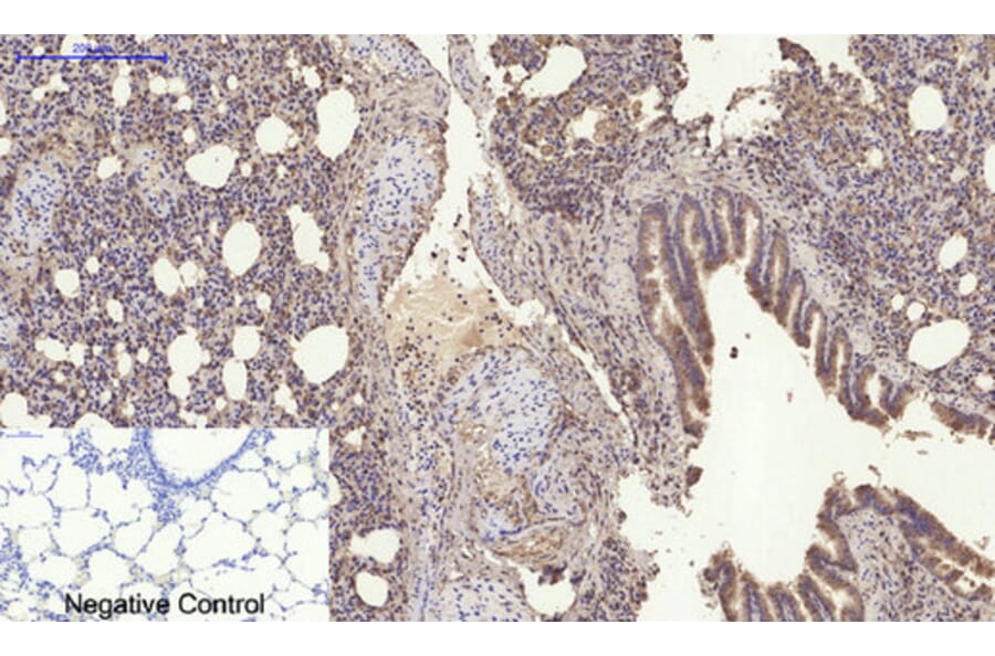 Immunohistochemistry - Anti-TNFSF11 Antibody (C30535) - Antibodies.com