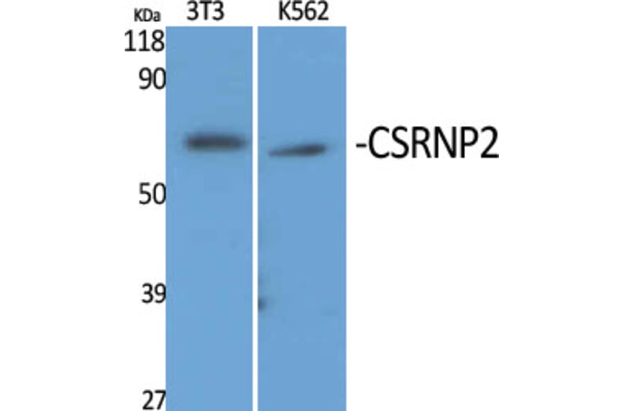 Western Blot - Anti-TAIP-12 Antibody (C20906) - Antibodies.com
