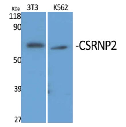 Western Blot - Anti-TAIP-12 Antibody (C20906) - Antibodies.com