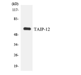 Western Blot - Anti-TAIP-12 Antibody (R12-3584) - Antibodies.com
