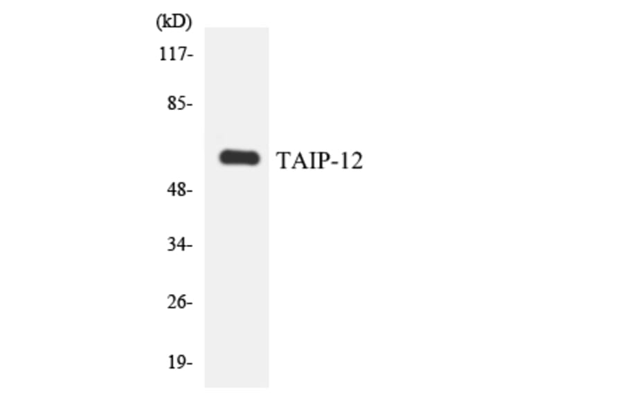 Western Blot - Anti-TAIP-12 Antibody (R12-3584) - Antibodies.com