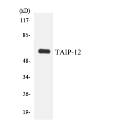 Western Blot - Anti-TAIP-12 Antibody (R12-3584) - Antibodies.com