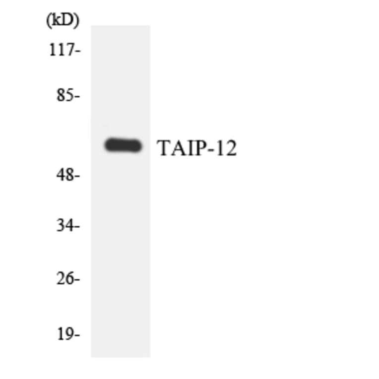 Western Blot - Anti-TAIP-12 Antibody (R12-3584) - Antibodies.com