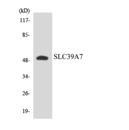 Western Blot - Anti-SLC39A7 Antibody (R12-3530) - Antibodies.com