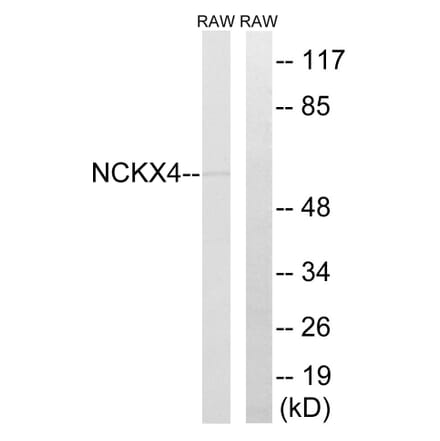 Western Blot - Anti-SLC24A4 Antibody (C18849) - Antibodies.com