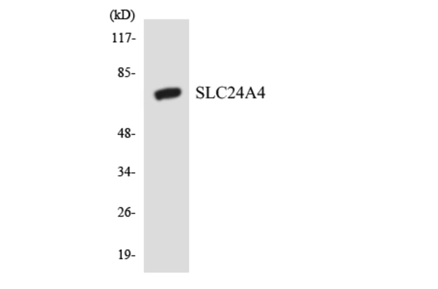 Western Blot - Anti-SLC24A4 Antibody (R12-3518) - Antibodies.com