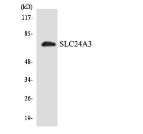 Western Blot - Anti-SLC24A3 Antibody (R12-3517) - Antibodies.com