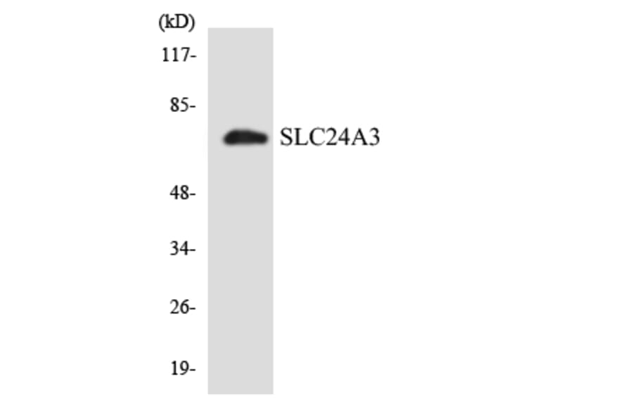 Western Blot - Anti-SLC24A3 Antibody (R12-3517) - Antibodies.com