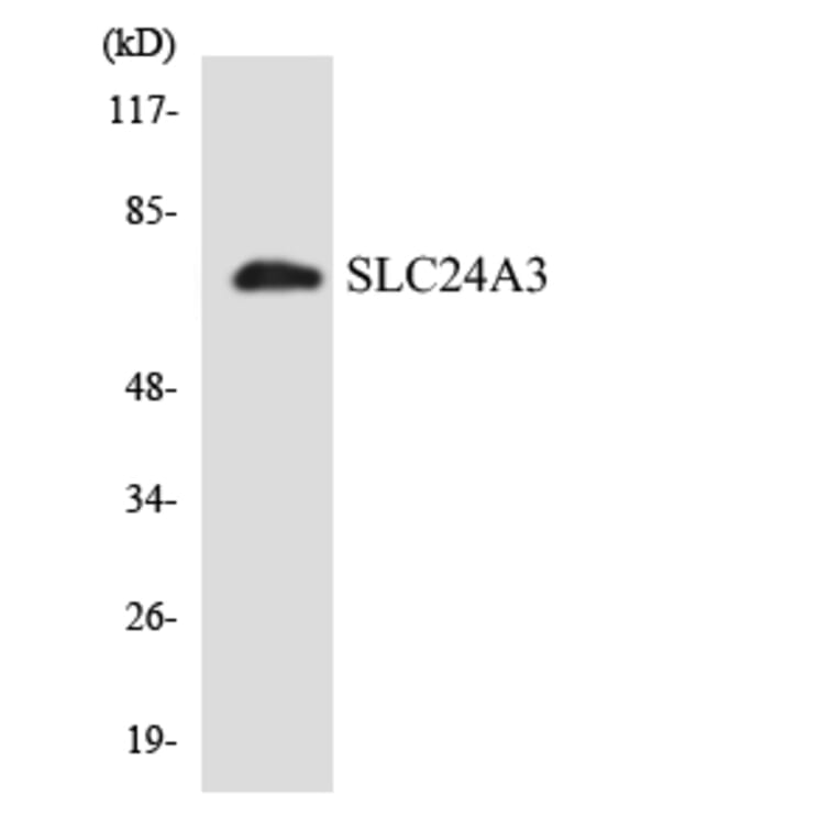 Western Blot - Anti-SLC24A3 Antibody (R12-3517) - Antibodies.com