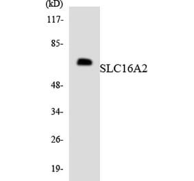 Western Blot - Anti-SLC16A2 Antibody (R12-3513) - Antibodies.com