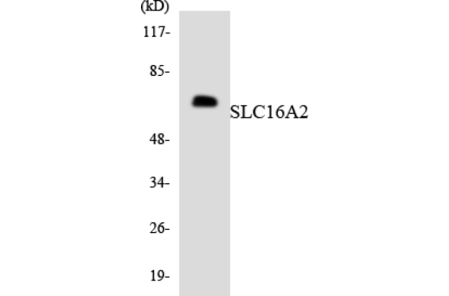 Western Blot - Anti-SLC16A2 Antibody (R12-3513) - Antibodies.com