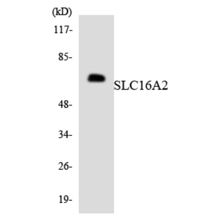 Western Blot - Anti-SLC16A2 Antibody (R12-3513) - Antibodies.com