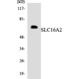 Western Blot - Anti-SLC16A2 Antibody (R12-3513) - Antibodies.com