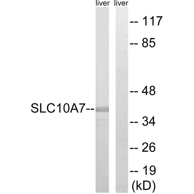 Western Blot - Anti-SLC10A7 Antibody (C18826) - Antibodies.com