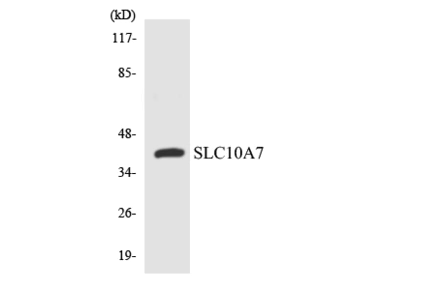Western Blot - Anti-SLC10A7 Antibody (R12-3511) - Antibodies.com