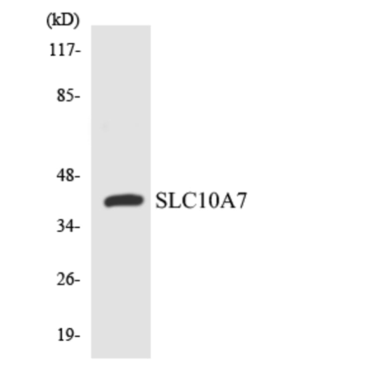 Western Blot - Anti-SLC10A7 Antibody (R12-3511) - Antibodies.com