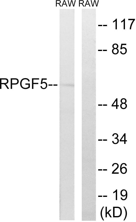 Western blot analysis of lysates from RAW264.7 cells using Anti-RAPGEF5 Antibody. The right hand lane represents a negative control, where the antibody is blocked by the immunising peptide.