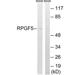 Western Blot - Anti-RAPGEF5 Antibody (C18170) - Antibodies.com