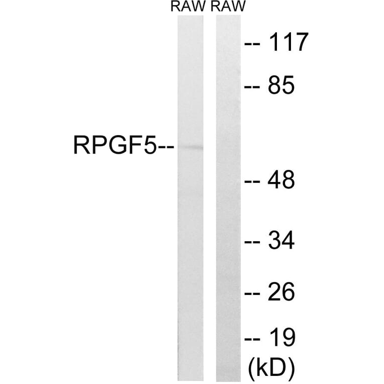 Western Blot - Anti-RAPGEF5 Antibody (C18170) - Antibodies.com