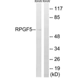 Western Blot - Anti-RAPGEF5 Antibody (C18170) - Antibodies.com